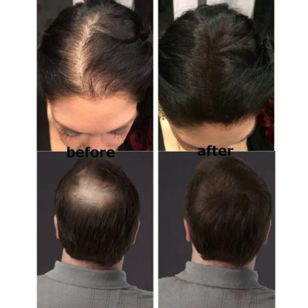 hair building fibers before after