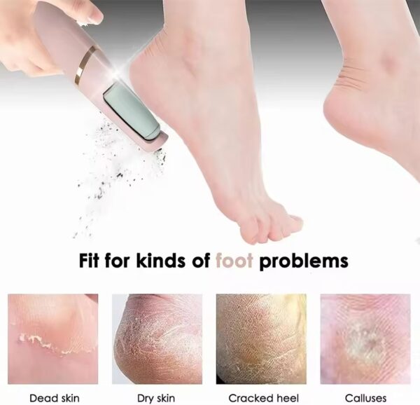 foot dead skin remover usage