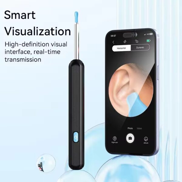ear wax removal kit smart visualization